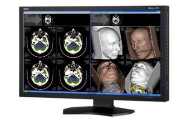 Erhöhte Produktivität bei der medizinischen Bildbetrachtung