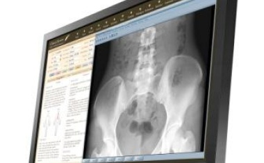 Für die medizinische Betrachtung: Der EIZO DICOM-Preset-Monitor MS230W