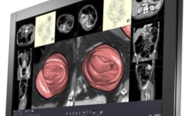 30“-Diagnose-Bildschirm für farbige und monochrome Aufnahmen