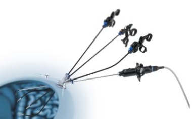 Olympus stellt neue Innovationen im Bereich der minimal-invasiven Chirurgie vor