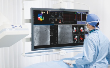 Reduzierte Strahlenbelastung bei Katheter-Interventionen