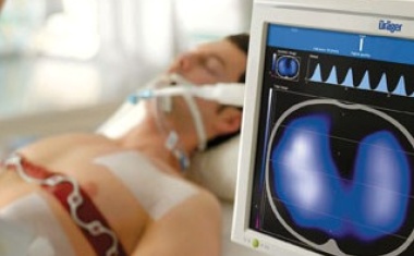 PulmoVista 500: Lungenfunktion kontinuierlich funktionell beurteilen