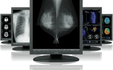 Befundungsmointore: Neue i2-Modelle von Totoko