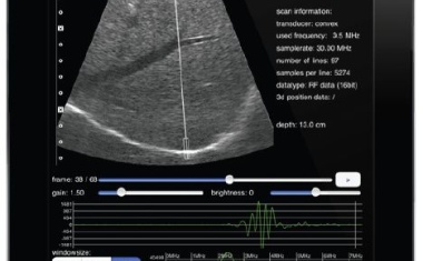 iPad/iPhone-App für die mobile Signalverarbeitung und Analyse von Ultraschallrohdaten