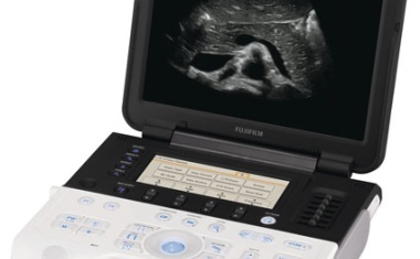 Mobiles Ultraschall-Gerät mit hoher Bildqualität