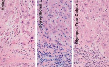 Mikroskopie im klinischen Bereich: Immer im rechten Licht