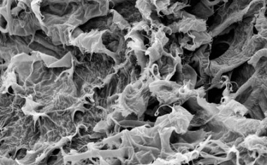 Cerasorb Ortho Foam zur Auffüllung von irregulären Knochendefekten