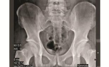 NEC MD211G3: Graustufen-Display mit 3 Megapixel-Bildauflösung für Primärdiagnostik