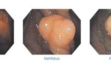 Olympus auf dem Kongress Viszeralmedizin 2012