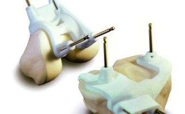 Knieendoprothetik: Zimmer Patient Specific Instruments (PSI)