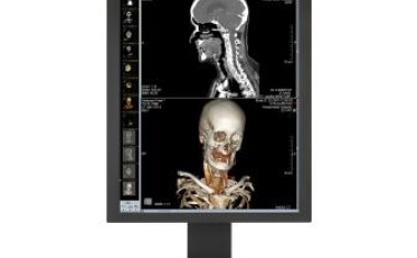 Farb-Befund-Monitore MD211C2 von NEC