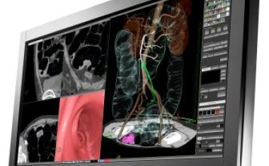 EIZO RadiForce RX840 Befundungsmonitor - Der Größte für die kleinsten Details