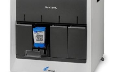 Clostridium difficile: Patientennahe Diagnostik „On Demand“