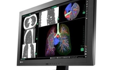 4-MegaPixel Befundungsmonitor für unterschiedliche bildgebende Verfahren