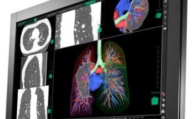 EIZO RadiForc RX440 Befundungsmonitor für unterschiedliche bildgebende Verfahren