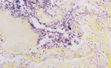 Roche führt vollautomatische Gram-Färbung für die Spezialfärbeplattform VENTANA BenchMark Special Stains ein