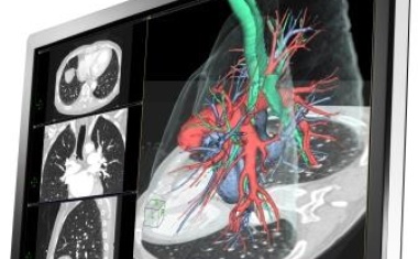 EIZO RadiForce RX650: Die neue Größe in der EIZO Multi-Modality-Serie