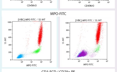 Fix your perm protocol by choosing PerFix-nc  for fast, reliable, high quality results