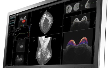 EIZO RadiForce RX850 - Neuer Multi-Modality-Farbmonitor mit 8 Megapixeln