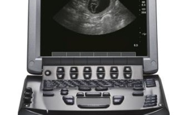 Sonosite M-Turbo: Tragbares Ultraschallsystem für den Point of Care