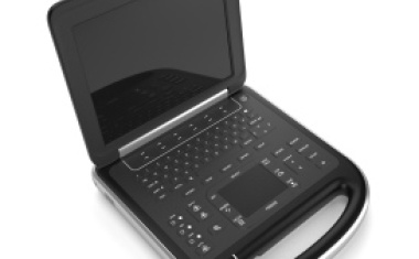 Sonosite Edge mit adaptiver Bildklarheit durch SonoHD2-Technologie