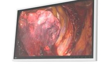 EIZO: Monitor für die Anzeige medizinischer Bilder in Operationssälen
