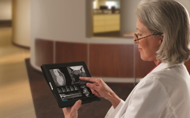 Philips IntelliSpace Portal: Multimodale Visualisierung und Analyse