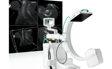 Mobile C-Bögen: Vom OP zum Hybridraum