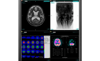 3-Megapixel-Befundungsmonitor EIZO RadiForce RX350 im neuen Design und mit überzeugender Bildschärfe