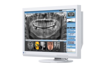 Befundungsmonitor EIZO RadiForce MX232W-DT für Dentalaufnahmen