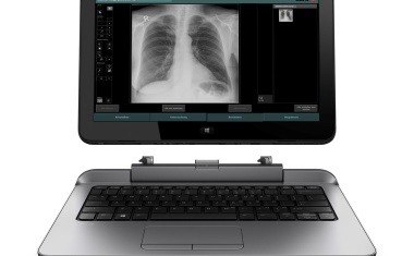 DR Retrofit-Lösung von Agfa HealthCare: Schnell und mobil zur Direktradiographie