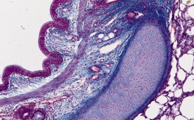 4K-Mikroskopie - See More, Show More, Save Time!