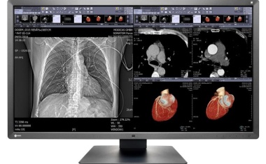 EIZO 4K-Monitor RadiForce MX315W für radiologische Aufnahmen