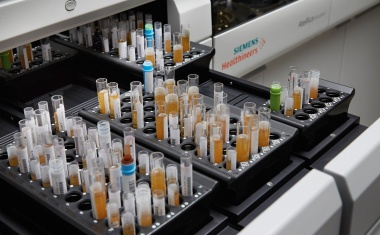 Neue Atellica Solution von Siemens Healthineers für fortschrittliche Labordiagnostik erhältlich