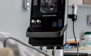 Ultraschallsystem Sonosite SII für höchsten Patientendurchsatz