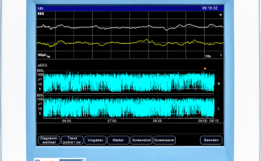 Der Braintrend aEEG-Monitor für die Neonatologie