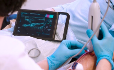 Point-of-Care-Ultraschall: Dialyse angenehmer gestalten