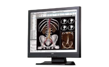 Neuer Farbmonitor zur Bildbetrachtung in der Radiologie