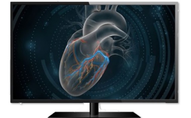 Ganzheitliche Lösungen für die Kardiologie