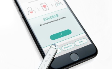 Kontinuierliche Herzüberwachung von Patienten mit Herzrhythmusstörungen