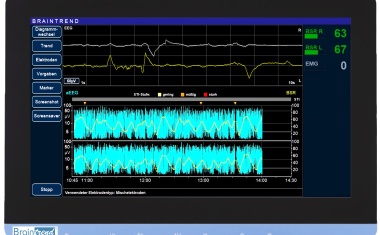 Braintrend: Zerebrale Überwachung in Neonatrologie und Pädiatrie