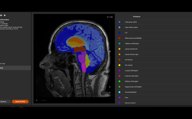 KI-basierte Assistenten für die Magnetresonanztomographie