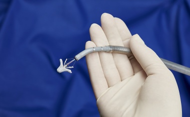 Minimalinvasiver Eingriff bei Patienten mit Mitralklappen-insuffizienz