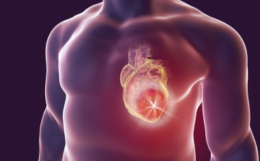 Plötzlicher Herztod: Risiken erkennen – Zeit gewinnen