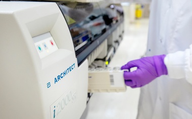 COVID-19-Antikörper-Bluttest