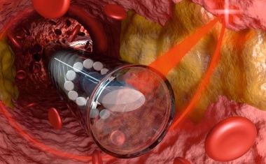 Kleinstes 3D-gedrucktes Miniatur-Endoskop