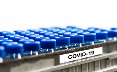 COVID-19 IgM-Antikörper-Bluttest jetzt verfügbar