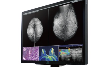 Ein Display für unterschiedliche diagnostische Bilder