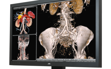 Ein Befundmonitor für alle Aufnahmen