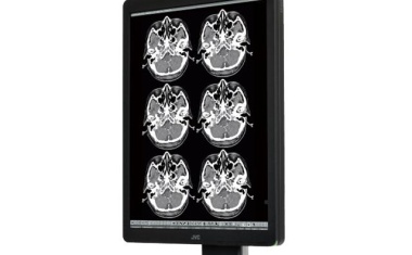Hochauflösendes Graustufen-Display für radiologische Bilddaten